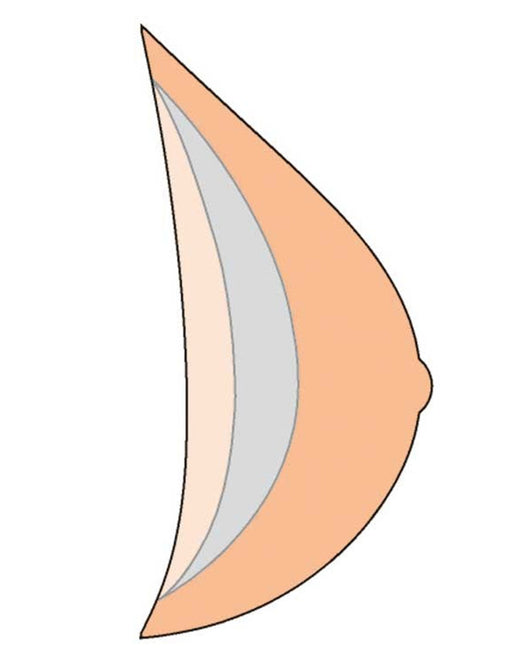 Natura Light 1SN 402 Breast Form - Ivory
