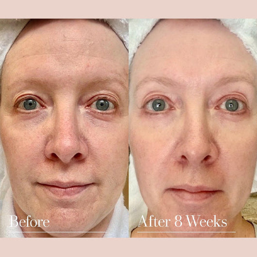 Six Peptides Anti Wrinkle Serum