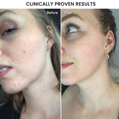 Brightening Vitamin C Cream